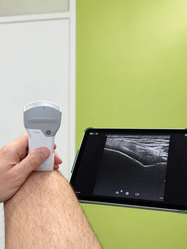 Ultraschalluntersuchung eines Knies mit mobilem Ger&auml;t